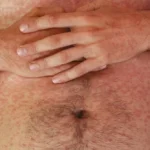 Síntomas del brote de sarampión en Uruguay