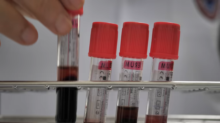 Frascos de medicamentos antirretrovirales utilizados en el tratamiento del VIH en hospitales bolivianos.