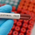 Investigadores descubren que variantes genéticas pueden elevar el colesterol LDL incluso con hábitos saludables.