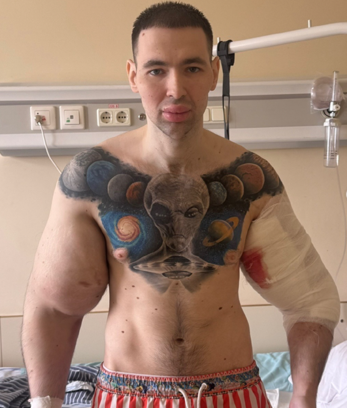 La dramática historia de Kirill Tereshin: El 'Popeye ruso' y su lucha por la vida 4 Kirill Tereshin Popeye ruso redes sociales viral tragedia médica