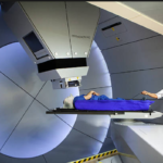 Tecnología de protones para cáncer de cabeza y cuello