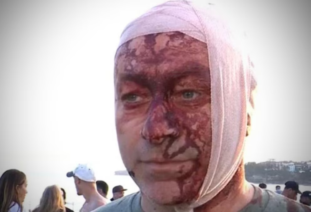 Herido en atentado antisemita en Australia