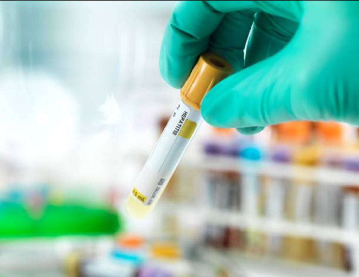 Vigilancia de hepatitis B en Uruguay Vigilancia de hepatitis B en Uruguay