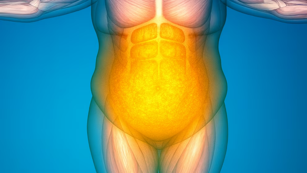 La nueva droga tirzepatida para obesidad ya está disponible en Argentina y la región 4 Lapicera inyectable de tirzepatida para obesidad