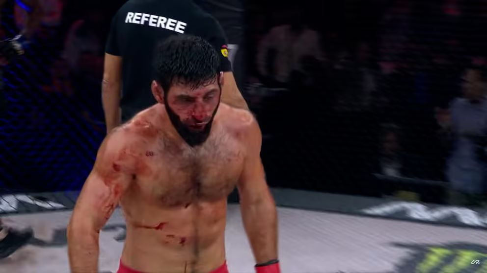 Umakhan Ibragimov desmayado tras el escándalo por una pelea promocionada por Cristiano Ronaldo