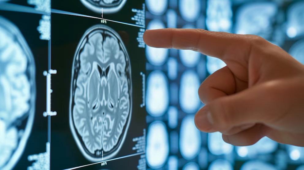 Investigación científica sobre demencia frontotemporal