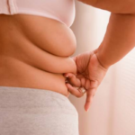Presentación médica que confirma que llegó a Uruguay un nuevo fármaco para tratar la obesidad
