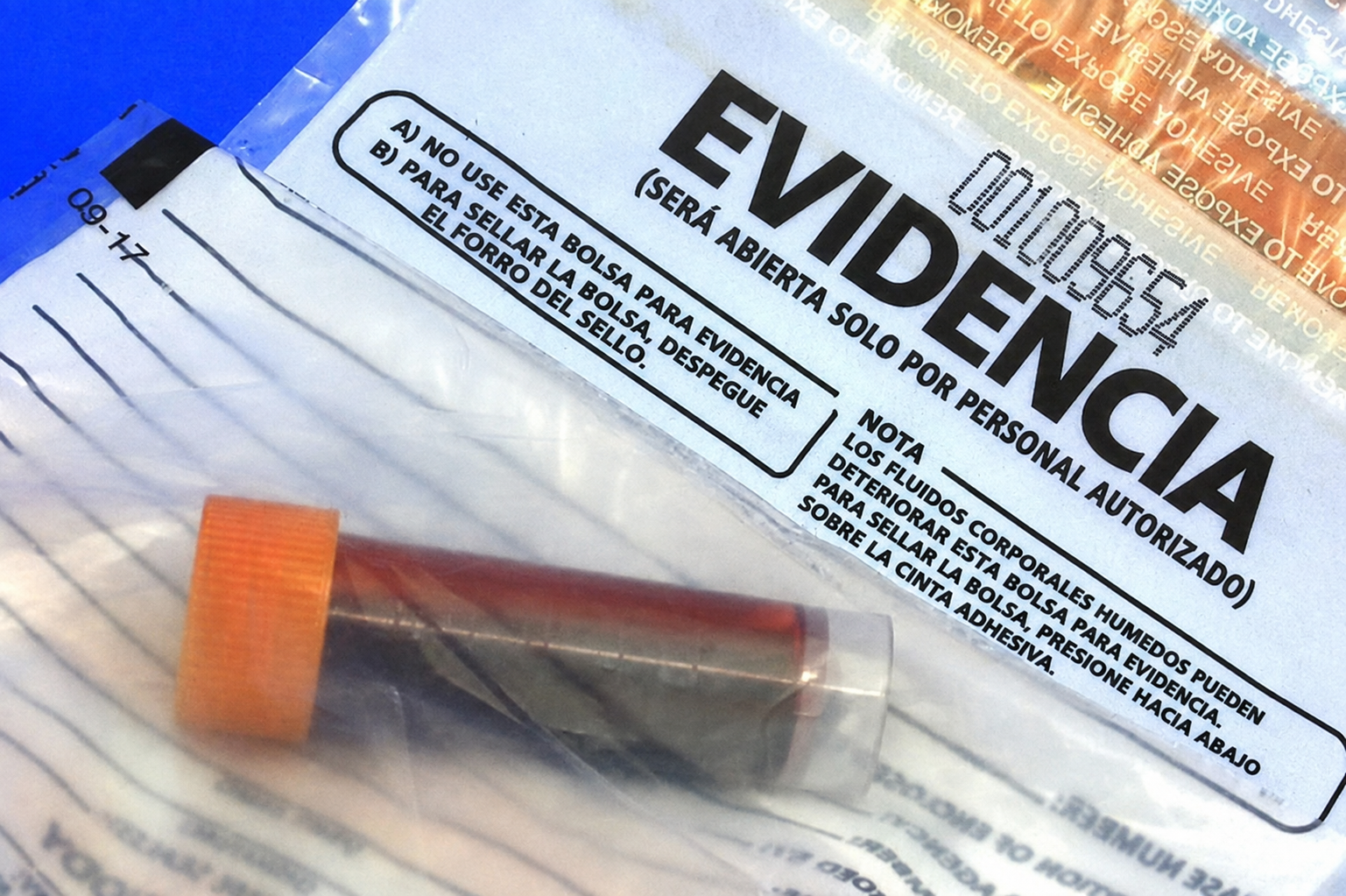 Escándalo en Salto: denuncian a un médico por atender borracho 1 Vehículo policial que intervino ante la denuncia contra el médico ebrio en la guardia