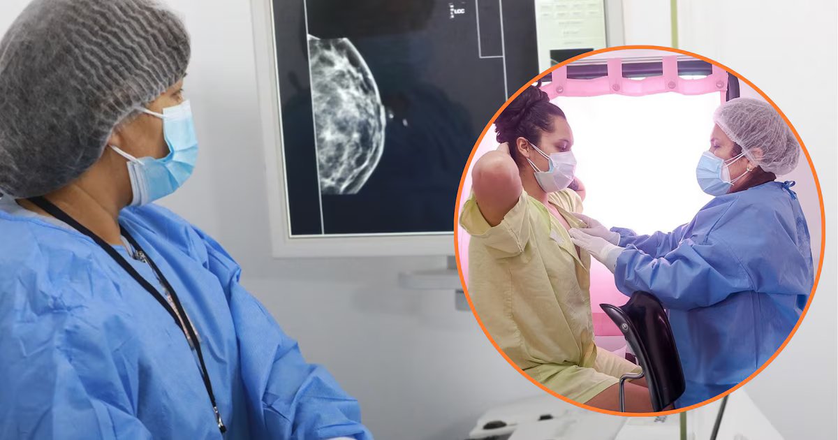Mujeres con riesgo elevado de recurrencia de cáncer de mama buscan tratamiento en el sistema de salud público