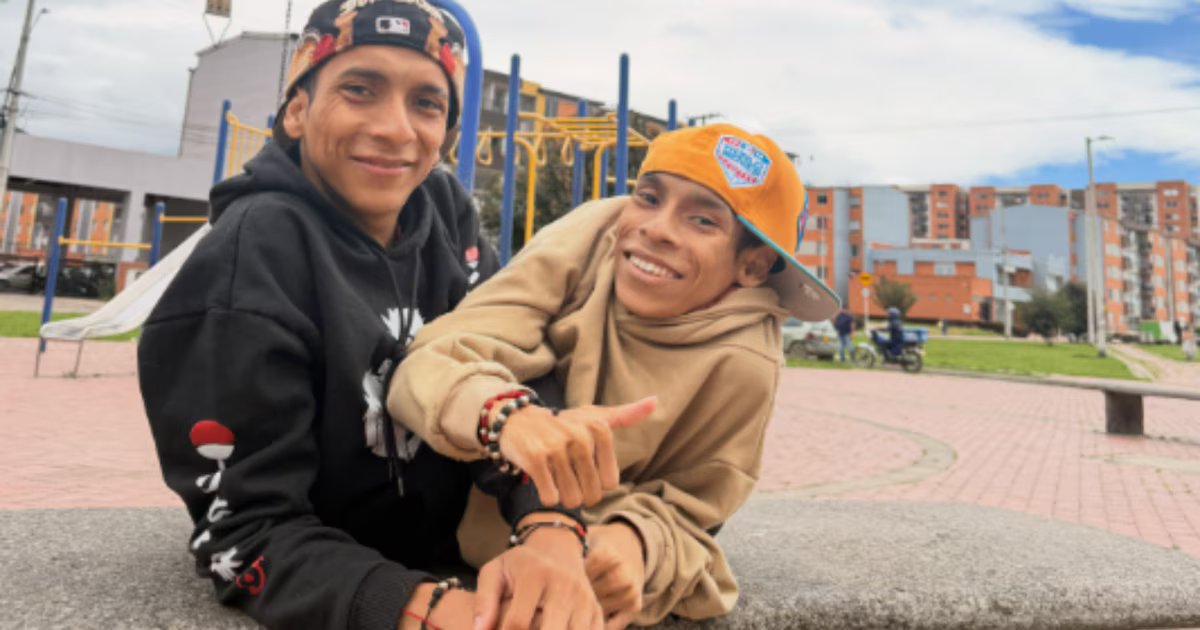 Fallecen en Colombia siameses ecuatorianos unidos por tórax por 27 años